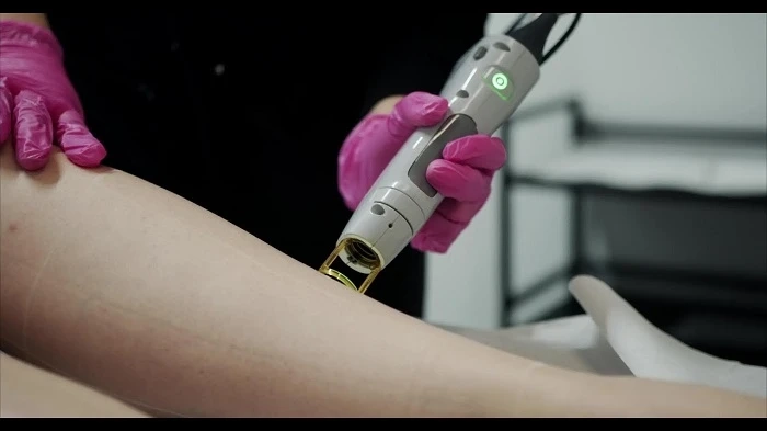 Laser Hair Removal Guide With Top Tips And Expert Knowledge