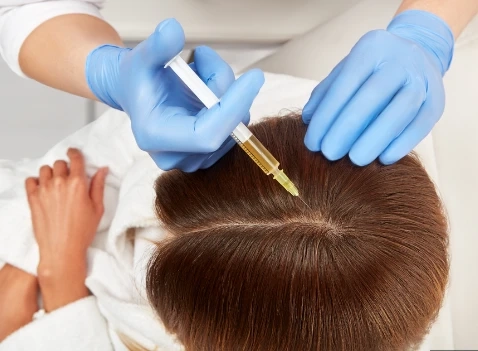 Understanding Plasma Injections for Hair Restoration