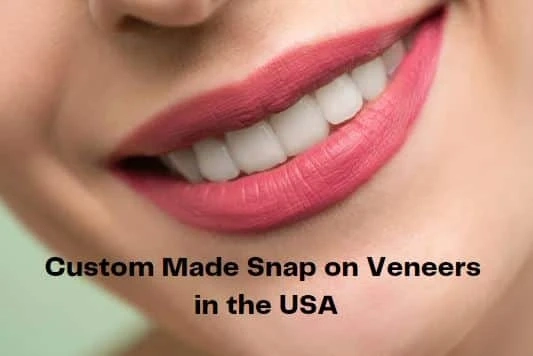 How to Use Snap On Veneers?