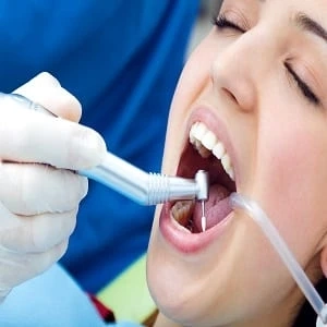 How does teeth whitening in the colony affect dental restorations like crowns or fillings?