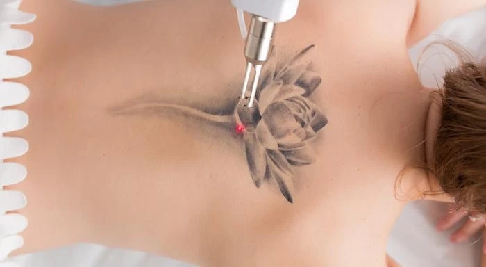 How to get your mind prepared for piercing and tattoo removal?