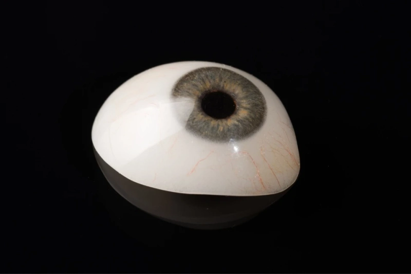 Ways to Take Care of Your Scleral Shell Prosthesis