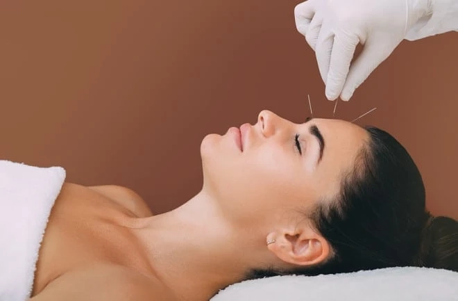 Acupuncture Can Treat Insomnia Problems