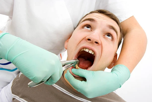 Tooth Extraction Recovery Tips for Faster Healing