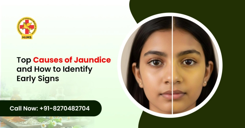 Top Causes of Jaundice and How to Identify Early Signs