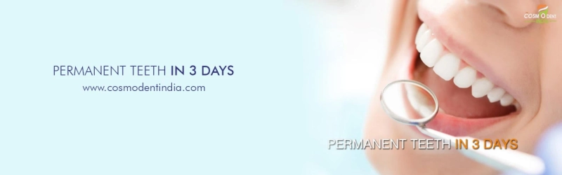 Permanent Dental Implants in 3 Days - Cosmodent India