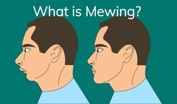 Know About Mewing: Experts Break Down What It Is and How to Do It