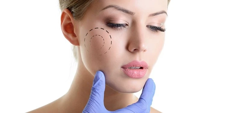 Frequently asked questions about bichectomy