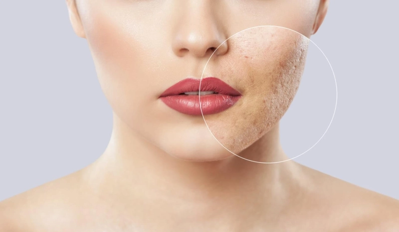 Finding a Botox Clinic That Meets Your Needs