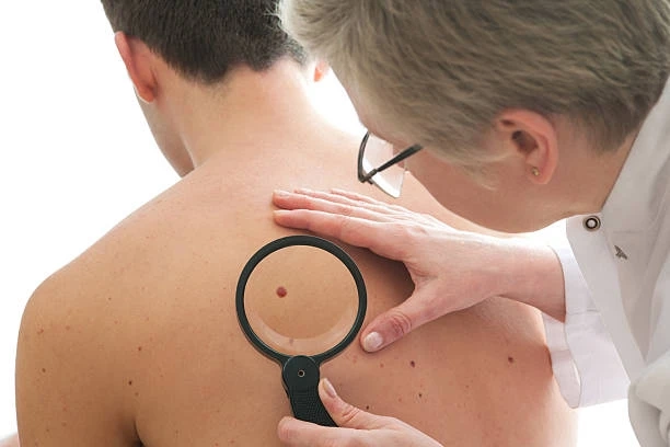 Mastering Skin Health: Dermoscopy in Riyadh Unveiled