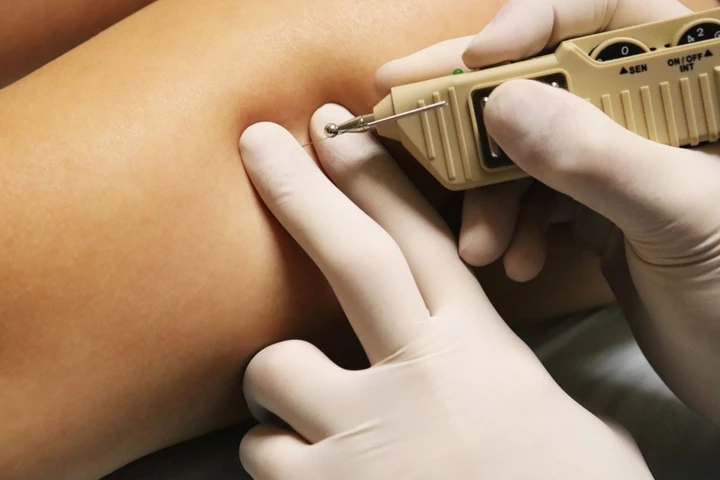 COVID-19 Impact on Neuromodulation Devices Market Share 2026