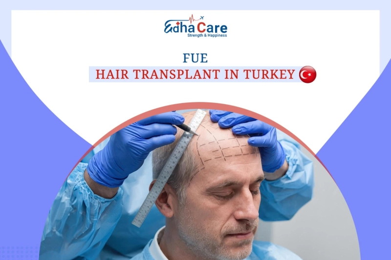 FUE Hair Transplant in Turkey: Natural Results and Efficient Recovery