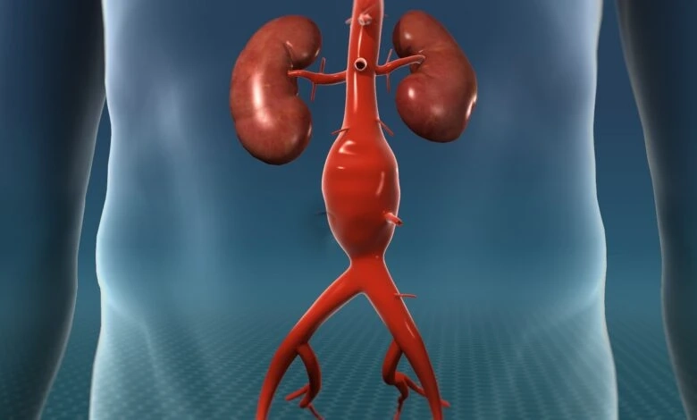 An increase in aortic aneurysm cases has led to a high demand for abdominal aneurysm repair devices