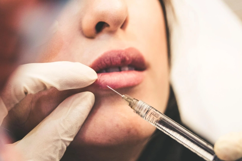 How Lip Fillers in Cardiff Can Boost Confidence