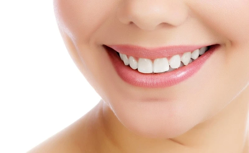 What You Should Know About Teeth Whitening?