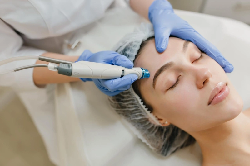 7 Proven Benefits of HydraFacial for Acne-Prone Skin in Dubai