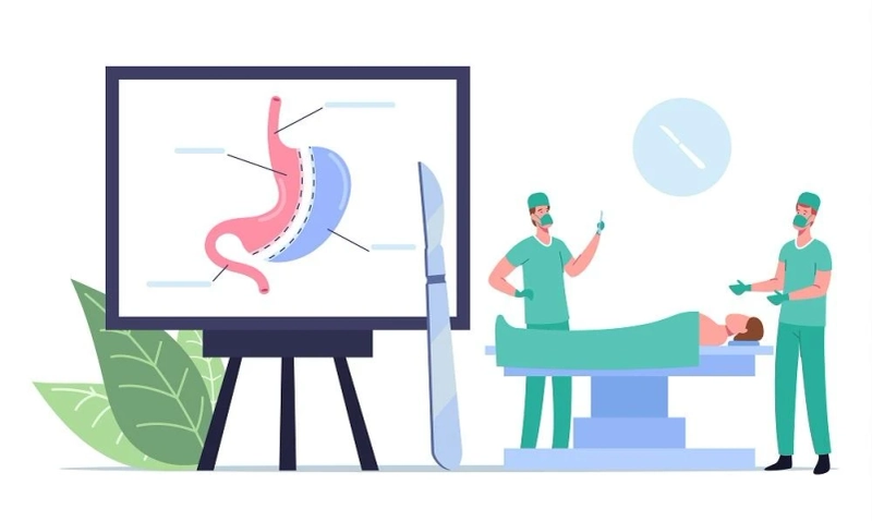 Upper Endoscopy: What Is It, Who Needs It, Risks & Benefits
