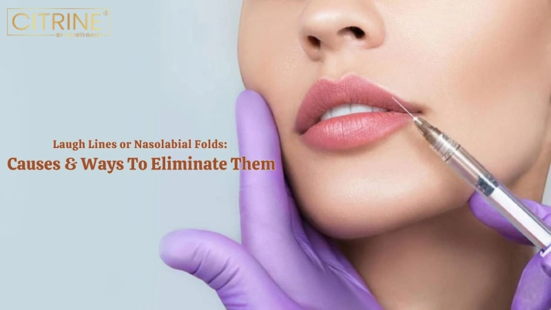 Laugh Lines or Nasolabial Folds: Causes & Ways To Eliminate Them