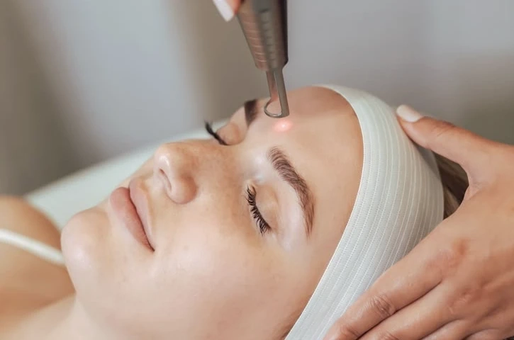How Erbium Laser Facial Resurfacing Treats Acne Scars and Sun Damage