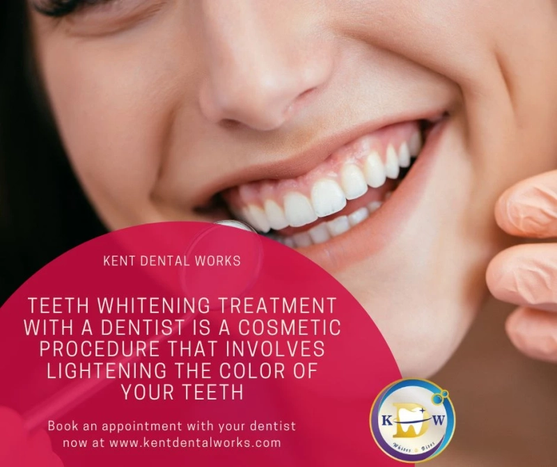 Teeth Whitening Costs and Options in Singapore