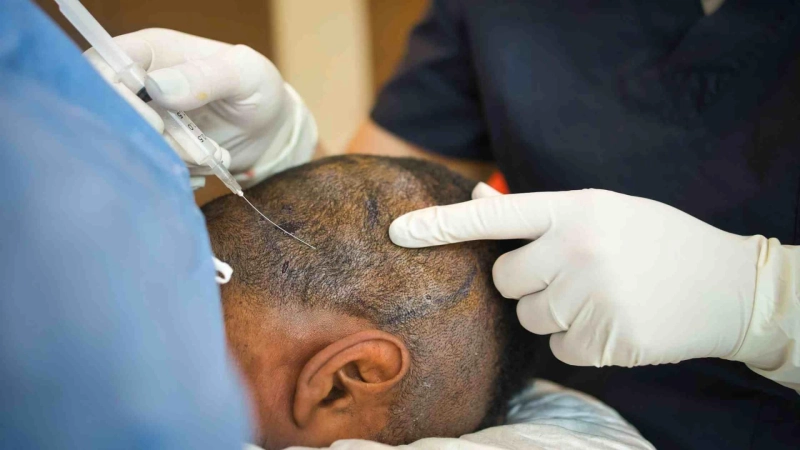What Makes the Best Hair Transplant in Mumbai Stand Out From the Rest?