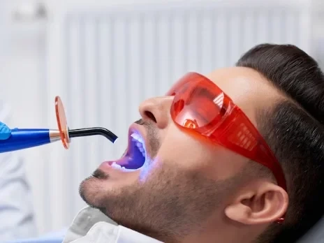 Teeth Whitening Cost, Procedure & Results Explained
