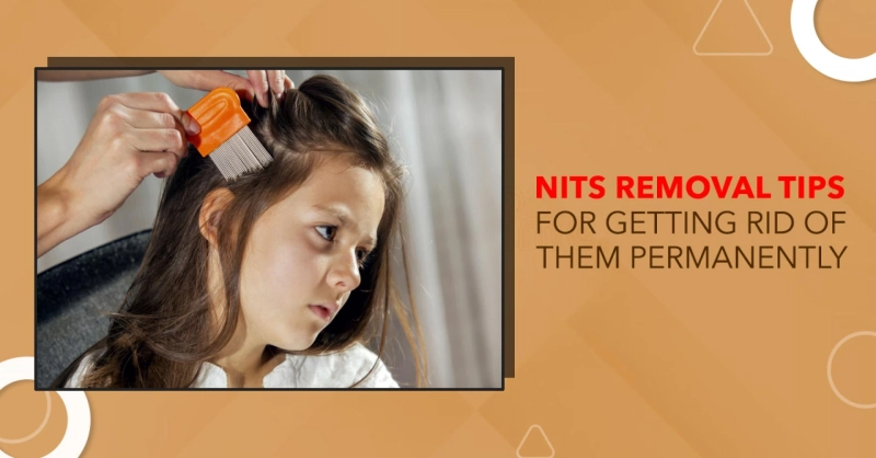 Nits Removal Tips For Getting Rid Of Them Permanently