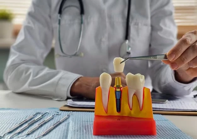 How to Choose the Right Dental Implant Dentist for Your Smile