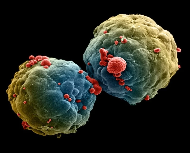 Global Wilms Tumor Protein Market Is Estimated To Witness High Growth Owing To Rising Demand for Diagnostic and Therapeutic Products