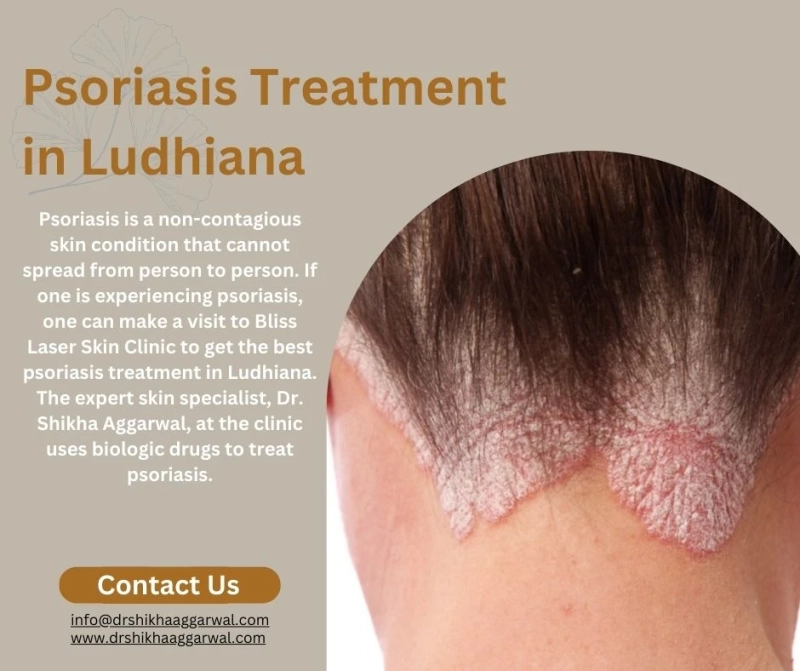 Will Psoriasis Spread to Other Parts of the Body?