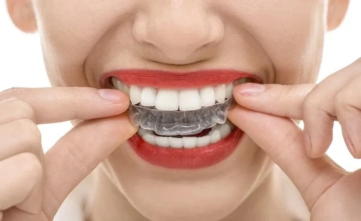 Looking for a Top Dentist in San Diego? Teeth Straightening Options Explained