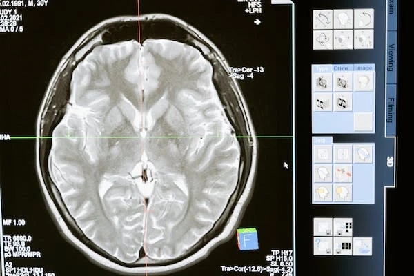 Elastography Imaging Global Market 2024 - By Insights, Size, Competitive Landscape, Analysis Forecast To 2033