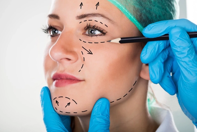 Understanding the Mid Facelift Procedure