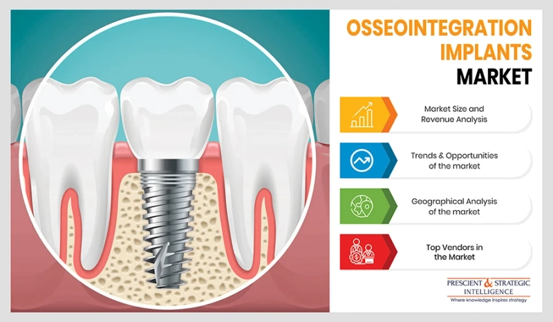 Osseointegration Implants Market Share, Size, Future Demand, and Emerging Trends