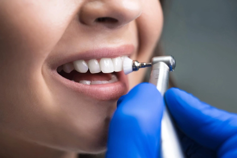 Why Professional Teeth Cleaning Is Important for Long-Term Oral Health