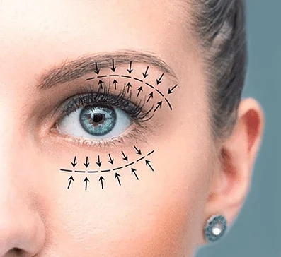 Upper vs. Lower Eyelid Surgery: Which Option Fits Your Needs in Cape Town? 