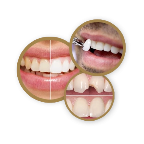 Teen Braces Help Enhance Appearance Of Children