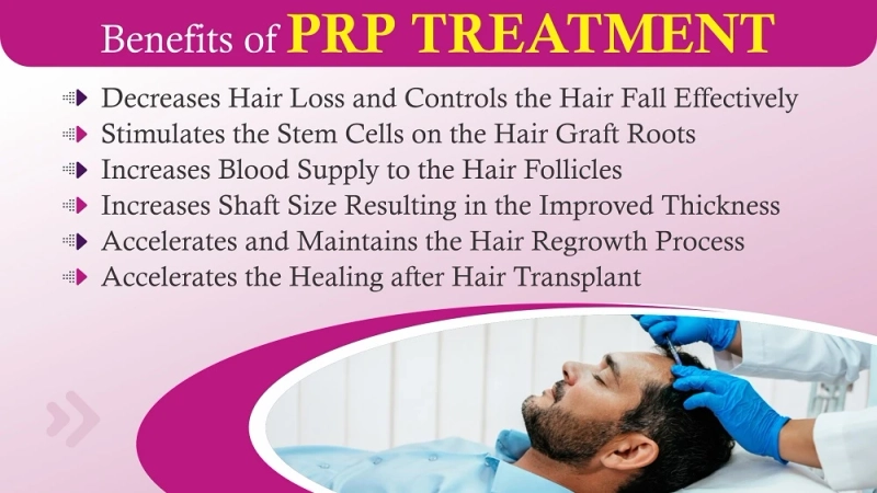 Explain The Importance of PRP Hair Restoration