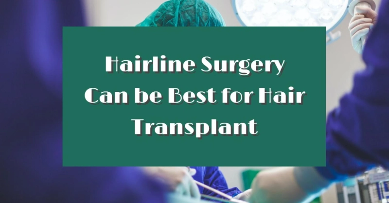 Hairline Surgery Can be Best for Hair Transplant