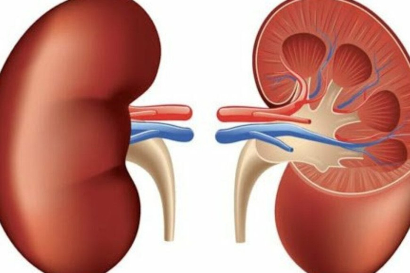 Who Should Consider a Simple Nephrectomy in Dubai?