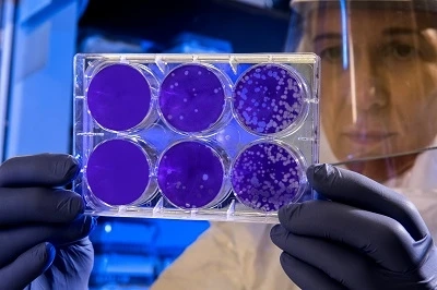 Intriguing new stem cell therapy offers hope for patients with chronic illnesses