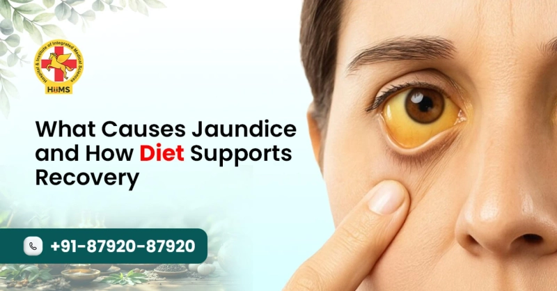 What Leads to Jaundice and How the Right Diet Aids Recovery