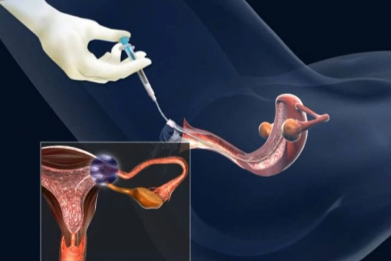 Makhdoom Lab: The Best IUI Centre in Mandi Bahauddin for Successful Fertility Treatments