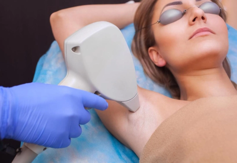 Laser Hair Removal: Benefits, Side Effects, and Cost | 3D Lifestyle