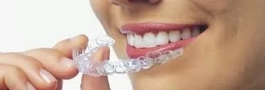 Why Invisalign San Diego is the Top Choice for Teenagers