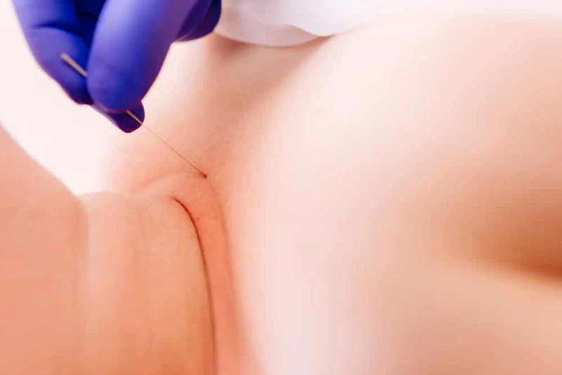 What Are the Physical Benefits of Massage?