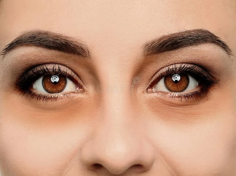 What Your Dark Circles Might Be Telling You About Your Health