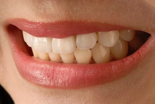 Teeth Whitening for Sensitive Teeth: What You Need to Know