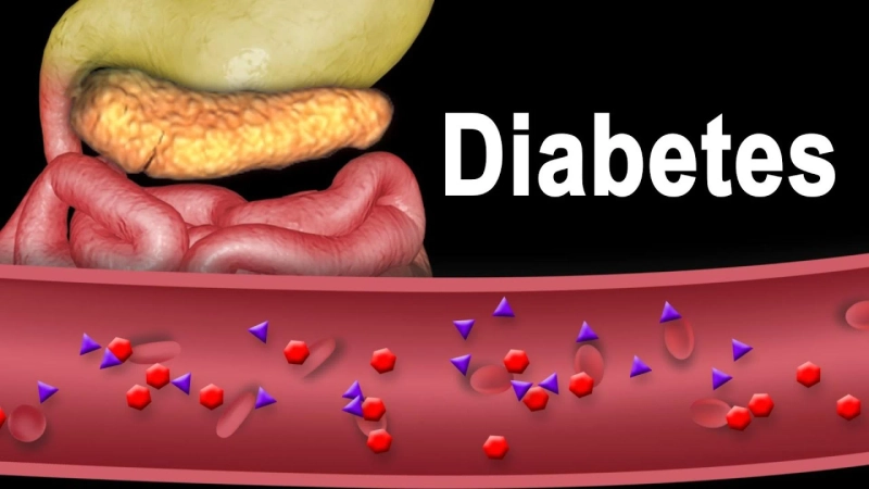Regulatory Insights Unveiled: Mastering the Diabetes Treatment Terrain | DLI