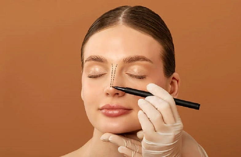 Discover the Top Advantages of Opting for Rhinoplasty in Riyadh